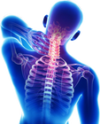 Neck Pain